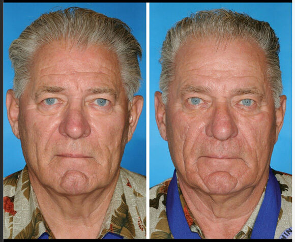 たばこを吸っている人特徴